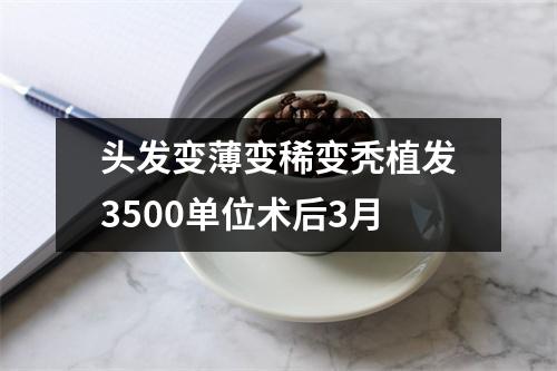 头发变薄变稀变秃植发3500单位术后3月