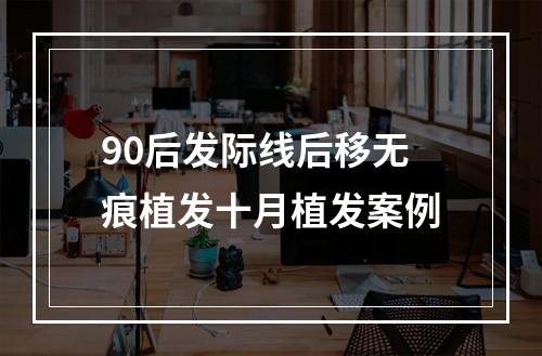 90后发际线后移无痕植发十月植发案例