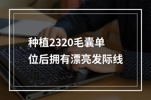 种植2320毛囊单位后拥有漂亮发际线