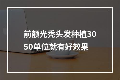 前额光秃头发种植3050单位就有好效果