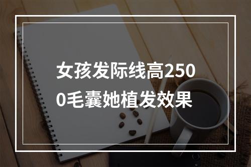 女孩发际线高2500毛囊她植发效果