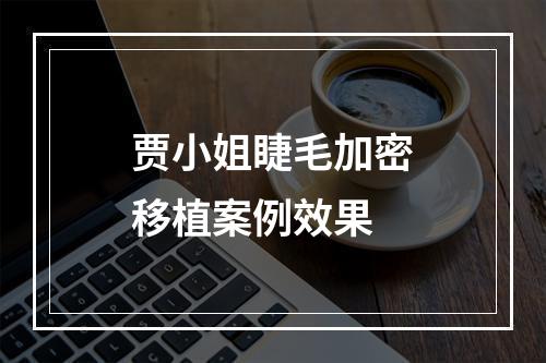 贾小姐睫毛加密移植案例效果