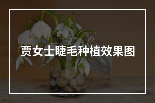 贾女士睫毛种植效果图