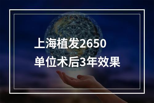 上海植发2650单位术后3年效果