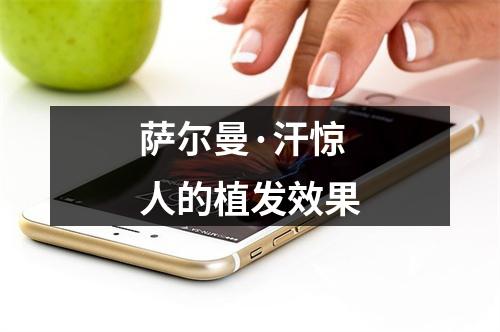 萨尔曼·汗惊人的植发效果