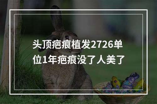 头顶疤痕植发2726单位1年疤痕没了人美了