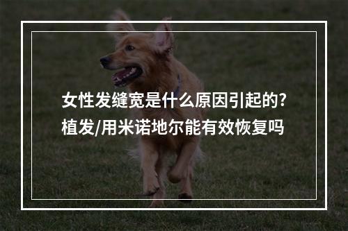 女性发缝宽是什么原因引起的?植发/用米诺地尔能有效恢复吗