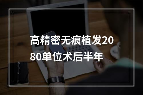 高精密无痕植发2080单位术后半年