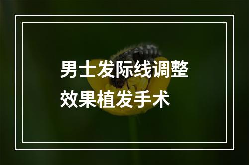 男士发际线调整效果植发手术