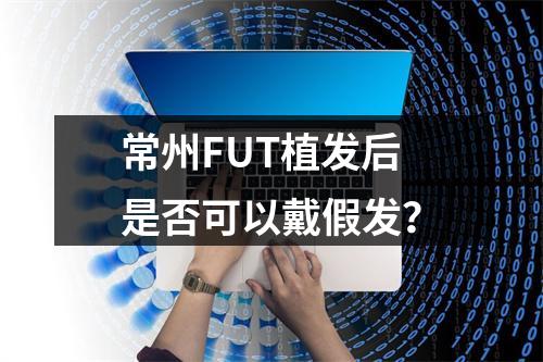 常州FUT植发后是否可以戴假发？