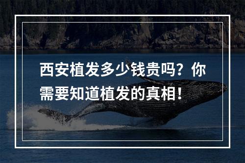 西安植发多少钱贵吗？你需要知道植发的真相！