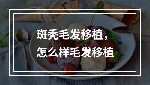 斑秃毛发移植，怎么样毛发移植