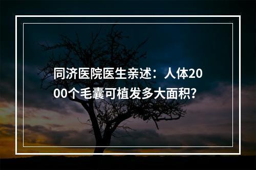 同济医院医生亲述：人体2000个毛囊可植发多大面积？