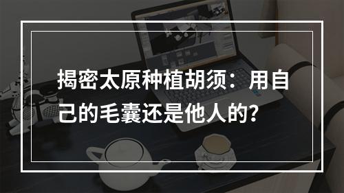 揭密太原种植胡须：用自己的毛囊还是他人的？