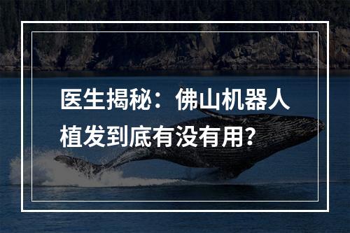 医生揭秘：佛山机器人植发到底有没有用？