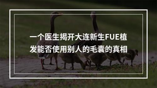 一个医生揭开大连新生FUE植发能否使用别人的毛囊的真相