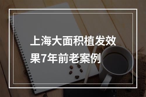 上海大面积植发效果7年前老案例