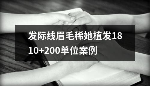 发际线眉毛稀她植发1810+200单位案例