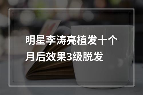 明星李涛亮植发十个月后效果3级脱发