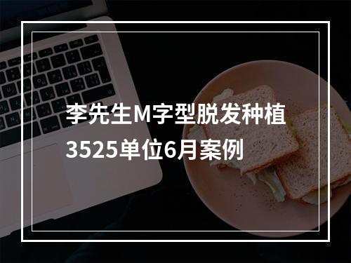 李先生M字型脱发种植3525单位6月案例