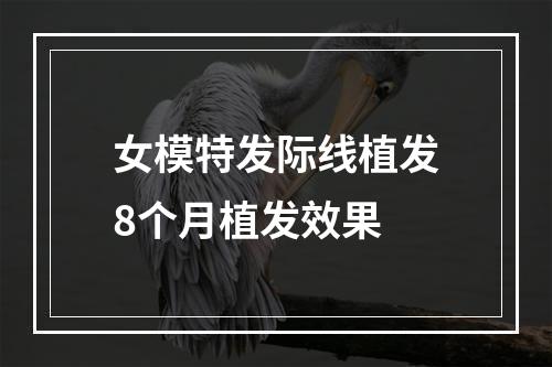 女模特发际线植发8个月植发效果