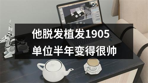 他脱发植发1905单位半年变得很帅