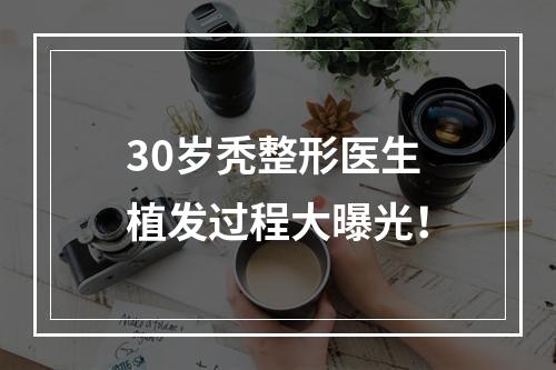 30岁秃整形医生植发过程大曝光！