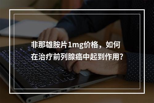 非那雄胺片1mg价格，如何在治疗前列腺癌中起到作用？