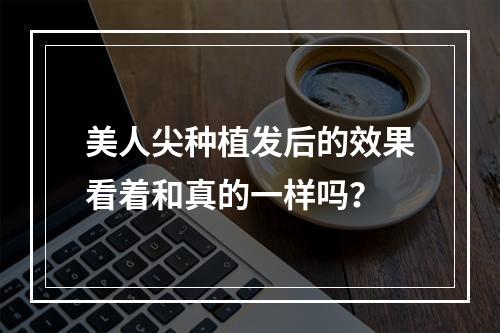 美人尖种植发后的效果看着和真的一样吗？