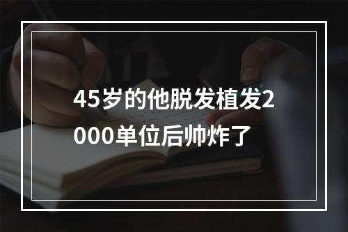 45岁的他脱发植发2000单位后帅炸了