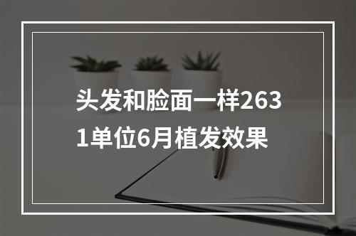 头发和脸面一样2631单位6月植发效果