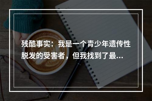 残酷事实：我是一个青少年遗传性脱发的受害者，但我找到了最有效的治疗方法！