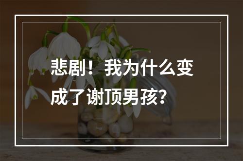 悲剧！我为什么变成了谢顶男孩？