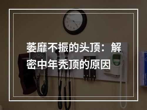 萎靡不振的头顶：解密中年秃顶的原因