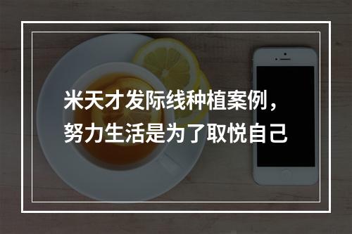 米天才发际线种植案例，努力生活是为了取悦自己