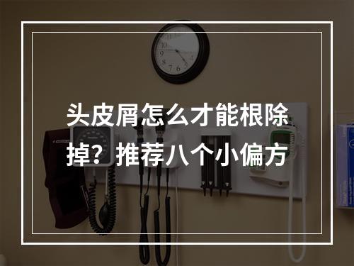 头皮屑怎么才能根除掉？推荐八个小偏方