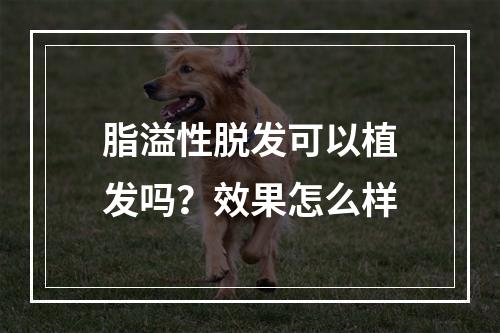 脂溢性脱发可以植发吗？效果怎么样