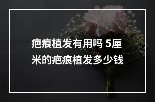 疤痕植发有用吗 5厘米的疤痕植发多少钱