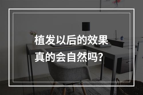 植发以后的效果真的会自然吗？