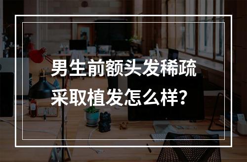 男生前额头发稀疏采取植发怎么样？