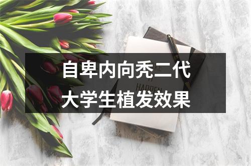 自卑内向秃二代大学生植发效果