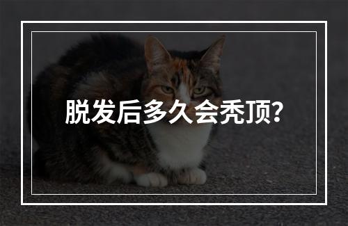 脱发后多久会秃顶？