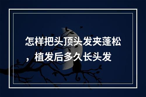 怎样把头顶头发夹蓬松，植发后多久长头发