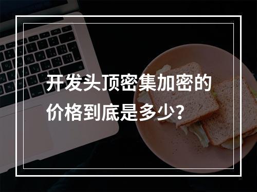 开发头顶密集加密的价格到底是多少？