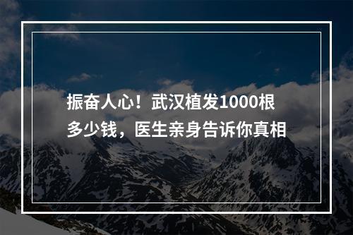 振奋人心！武汉植发1000根多少钱，医生亲身告诉你真相