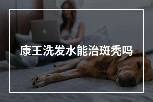 康王洗发水能治斑秃吗