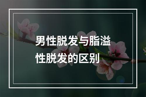 男性脱发与脂溢性脱发的区别