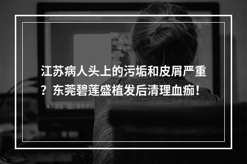 江苏病人头上的污垢和皮屑严重？东莞碧莲盛植发后清理血痂！