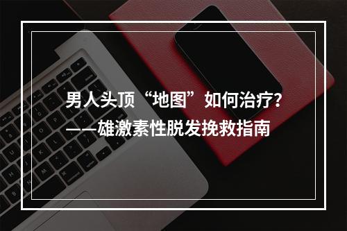 男人头顶“地图”如何治疗？——雄激素性脱发挽救指南