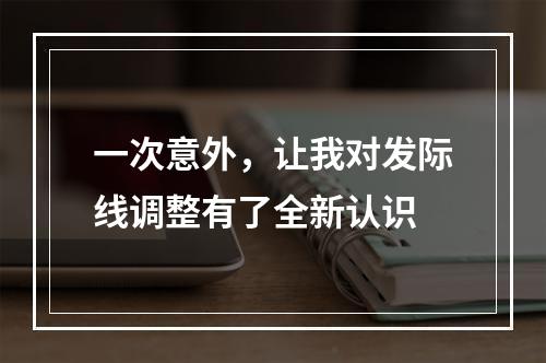 一次意外，让我对发际线调整有了全新认识